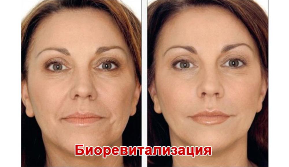 Farfalla Клиника лазерной косметологии