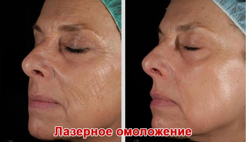 Farfalla Клиника лазерной косметологии