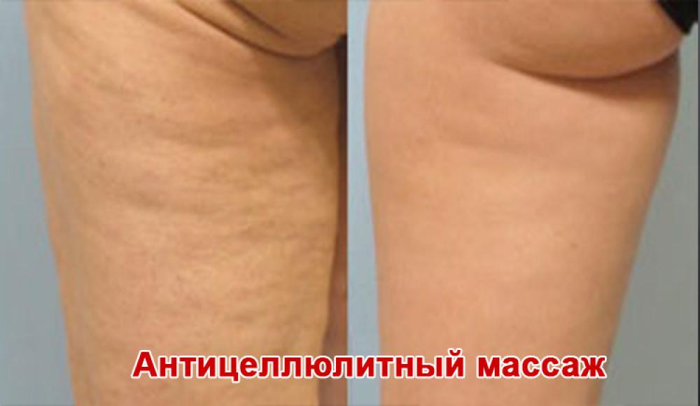 Farfalla Клиника лазерной косметологии