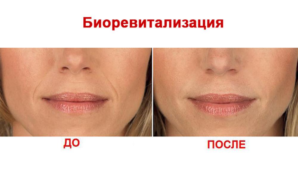 Farfalla Клиника лазерной косметологии