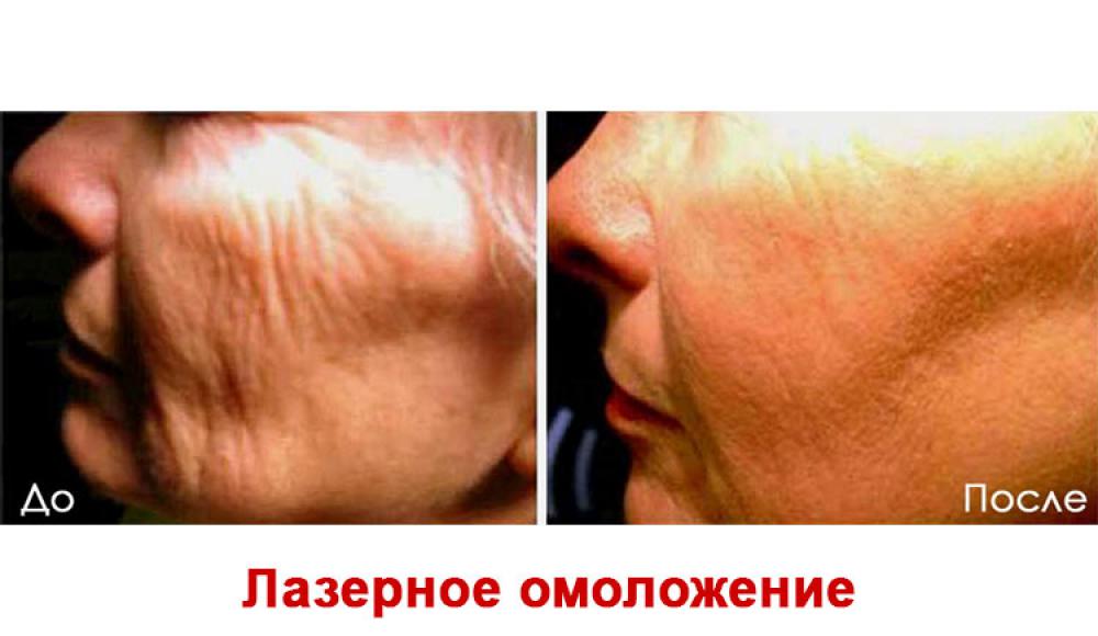 Farfalla Клиника лазерной косметологии