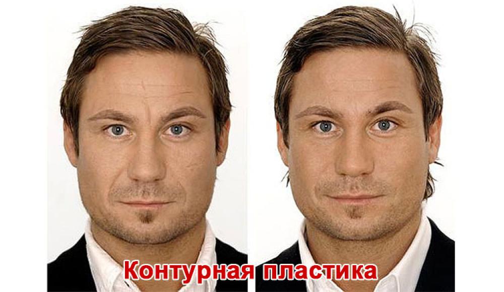 Farfalla Клиника лазерной косметологии