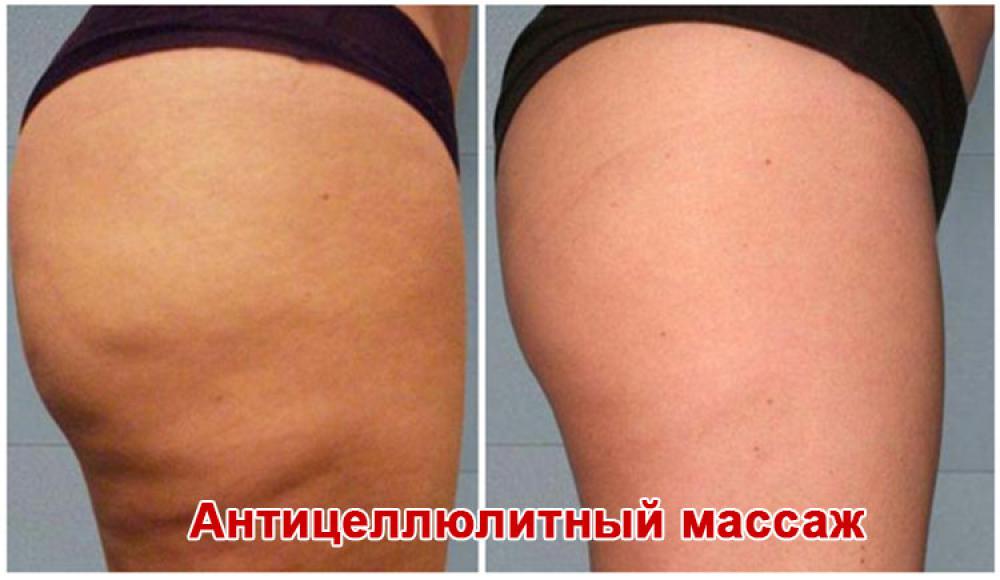 Farfalla Клиника лазерной косметологии