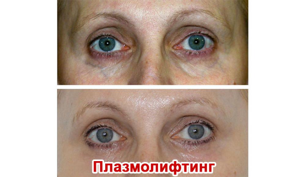Farfalla Клиника лазерной косметологии