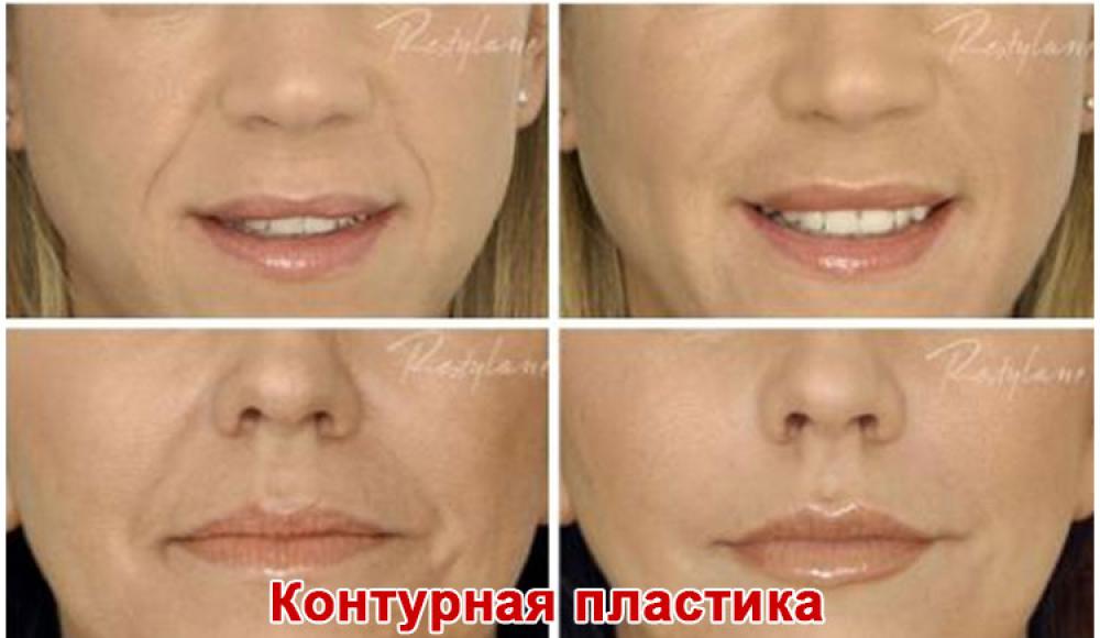 Farfalla Клиника лазерной косметологии
