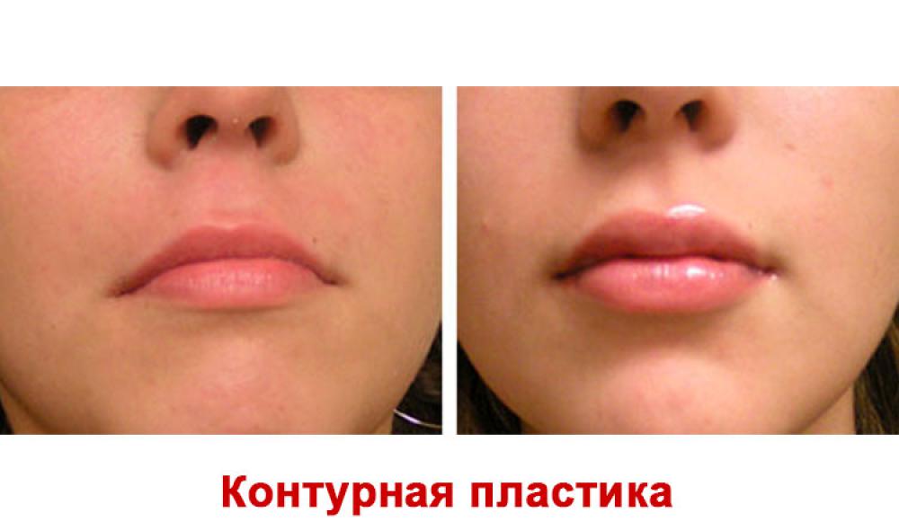 Farfalla Клиника лазерной косметологии
