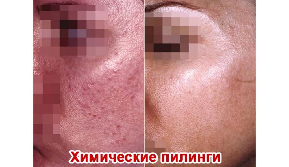 Farfalla Клиника лазерной косметологии