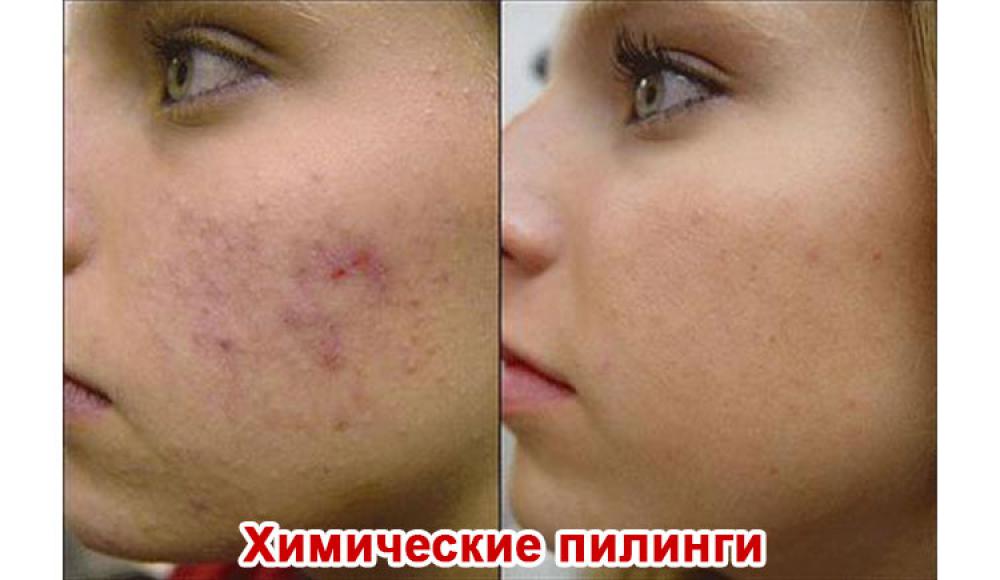 Farfalla Клиника лазерной косметологии