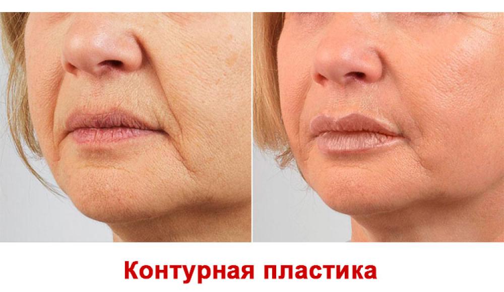 Farfalla Клиника лазерной косметологии