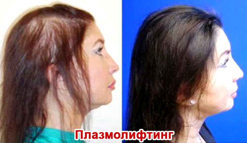 Farfalla Клиника лазерной косметологии
