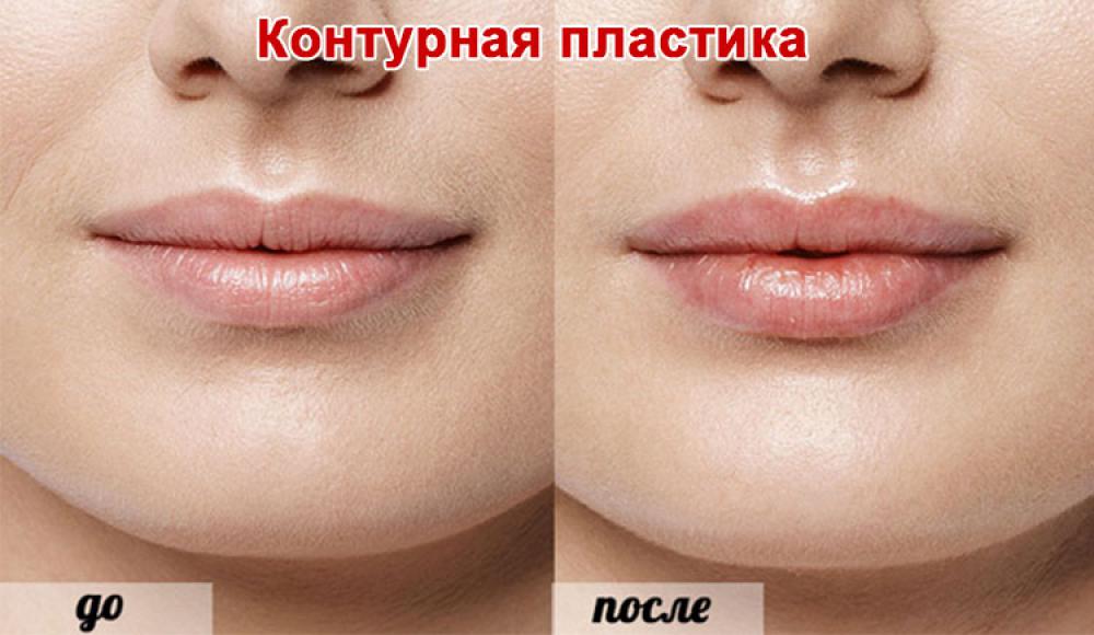 Farfalla Клиника лазерной косметологии