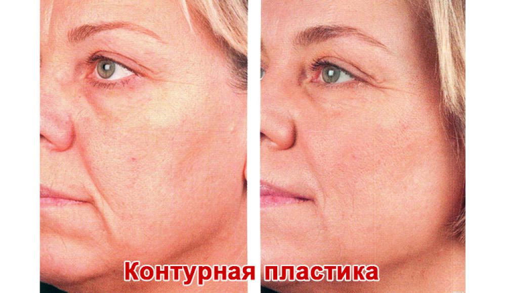 Farfalla Клиника лазерной косметологии
