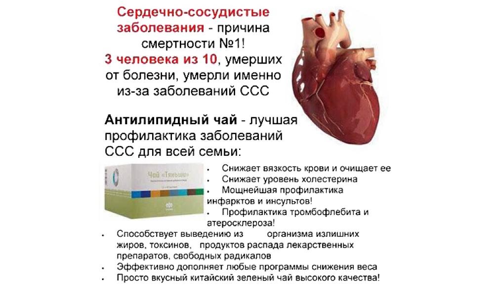 Продукция ТЯНЬШИ во Владикавказе