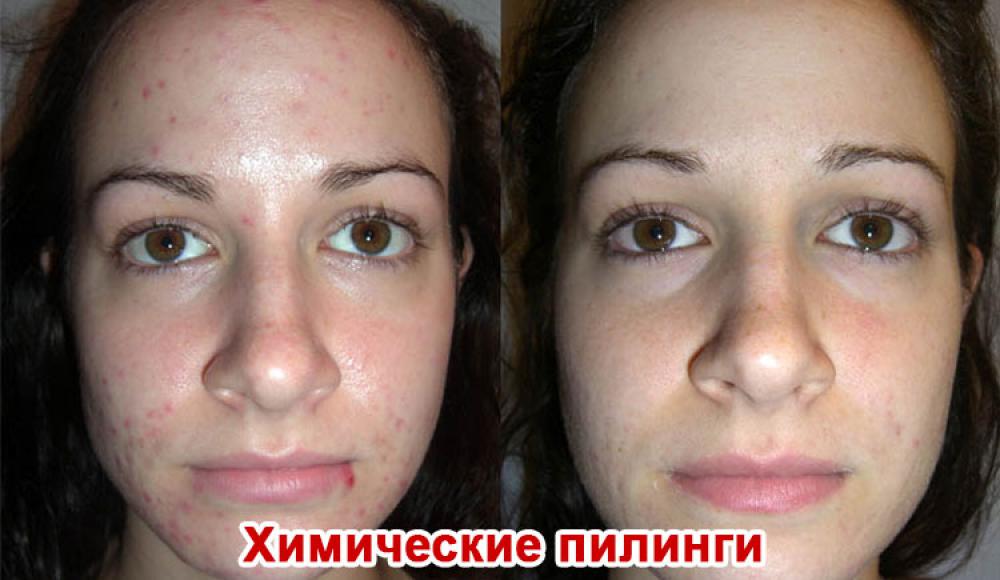 Farfalla Клиника лазерной косметологии