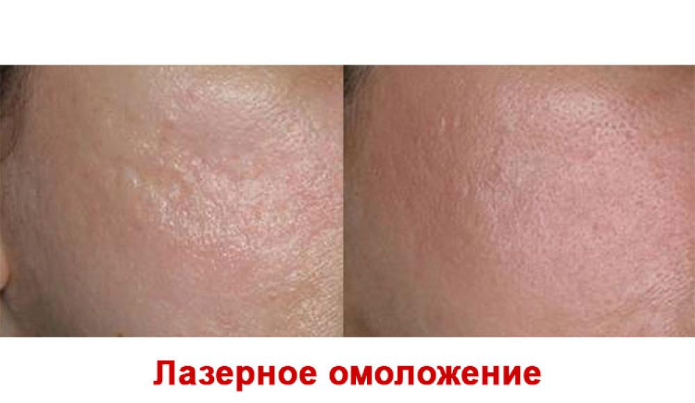 Farfalla Клиника лазерной косметологии