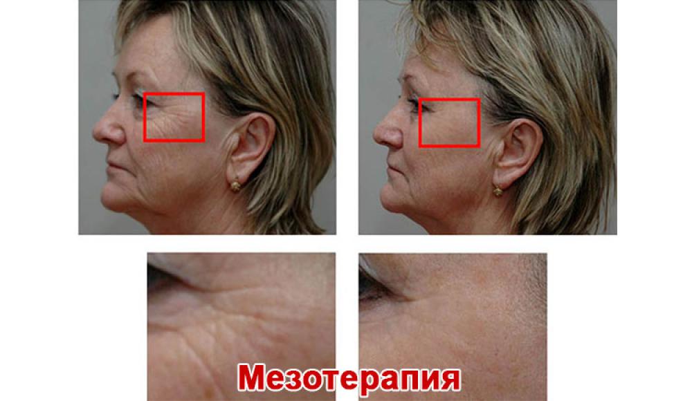 Farfalla Клиника лазерной косметологии