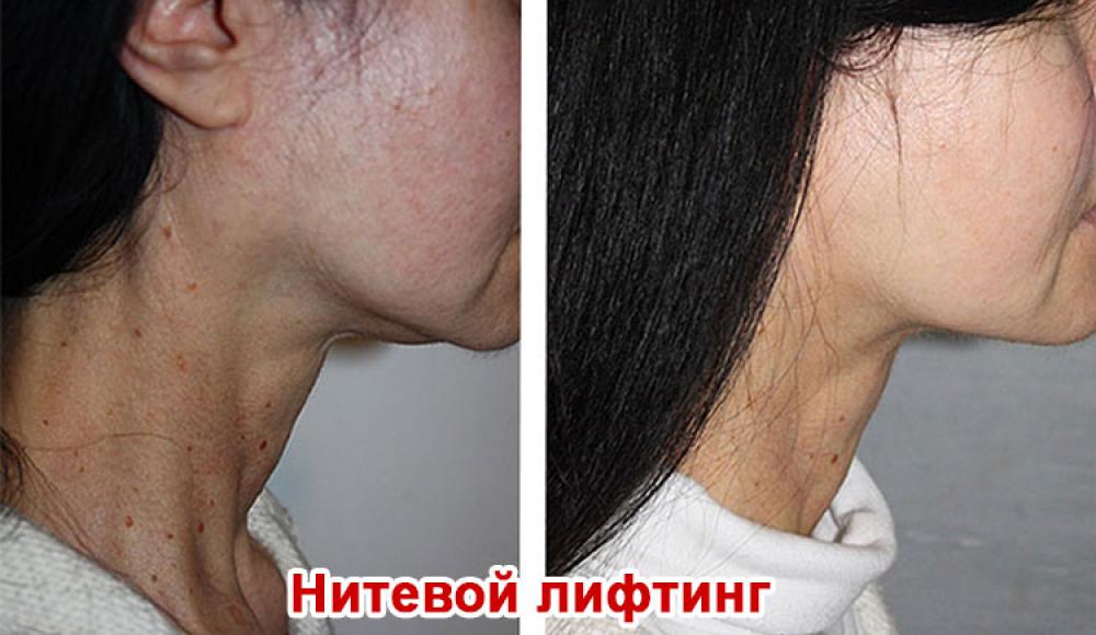 Farfalla Клиника лазерной косметологии