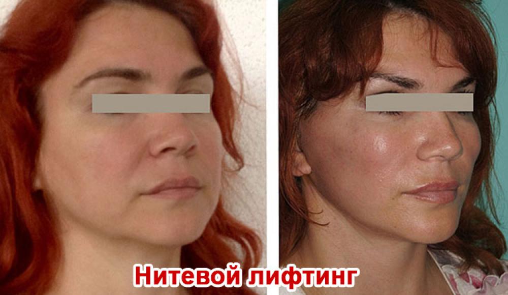 Farfalla Клиника лазерной косметологии