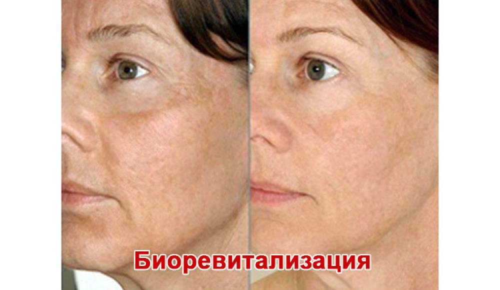 Farfalla Клиника лазерной косметологии